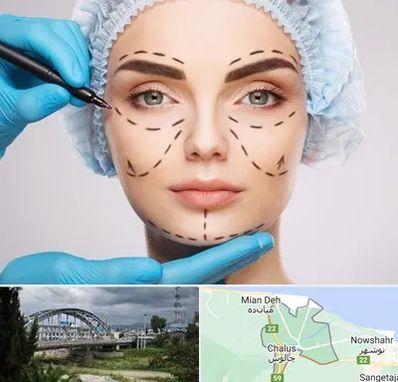 جراح پلاستیک در چالوس