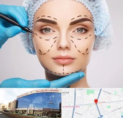 جراح پلاستیک در نصف راه تبریز