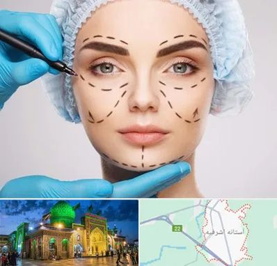 جراح پلاستیک در آستانه اشرفیه