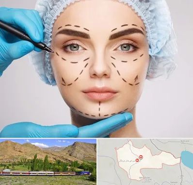 جراح پلاستیک در خاش