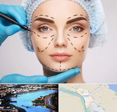 جراح پلاستیک در خرمشهر