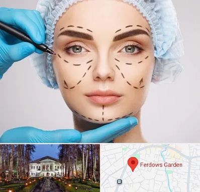 جراح پلاستیک در باغ فردوس