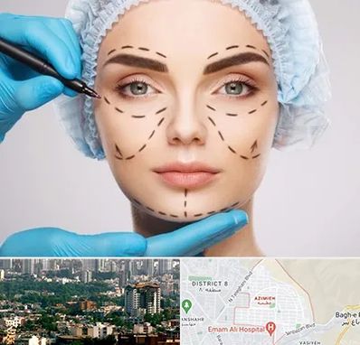 جراح پلاستیک در عظیمیه کرج