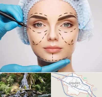 جراح پلاستیک در الیگودرز