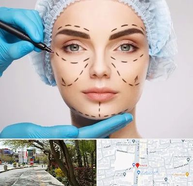 جراح پلاستیک در خیابان توحید اصفهان