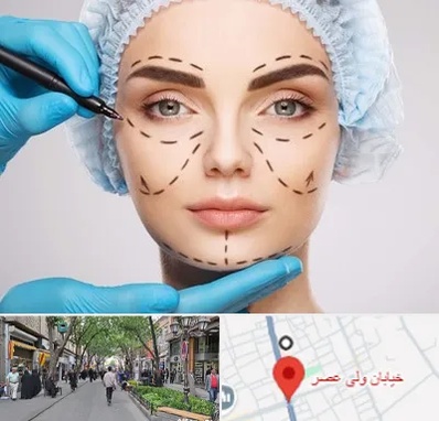 جراح پلاستیک در ولیعصر شهریار