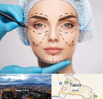 جراح پلاستیک در تبریز