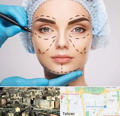 جراح پلاستیک در مرزداران