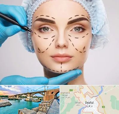 جراح پلاستیک در دزفول