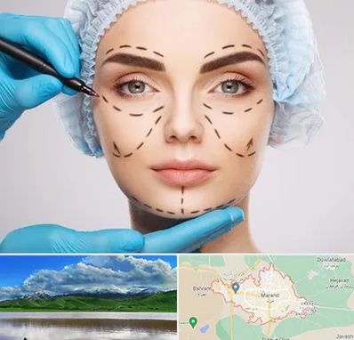 جراح پلاستیک در مرند