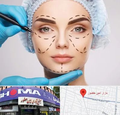 جراح پلاستیک در امین حضور