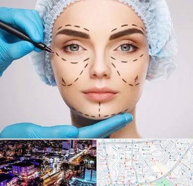 جراح پلاستیک در منظریه رشت