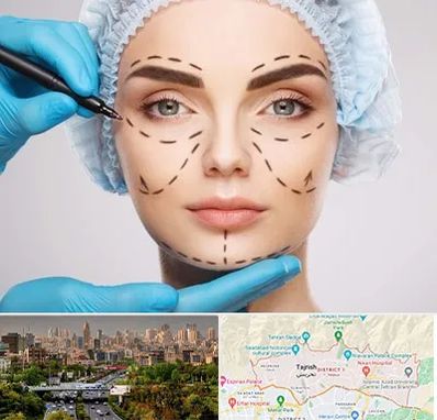 جراح پلاستیک در منطقه 1 تهران