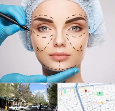 جراح پلاستیک در کوی فیروز تبریز