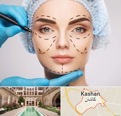 جراح پلاستیک در کاشان