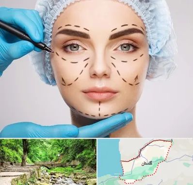 جراح پلاستیک در گلستان