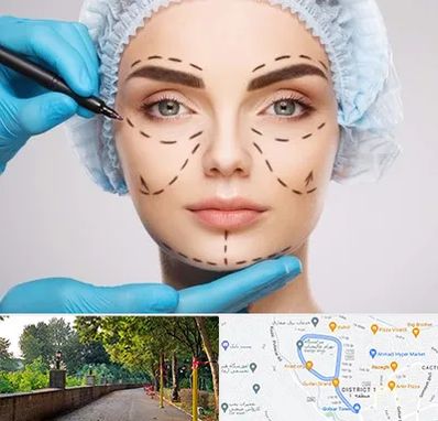 جراح پلاستیک در فلکه گاز رشت