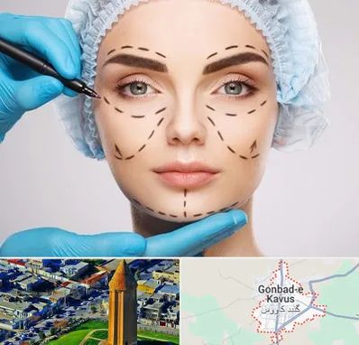 جراح پلاستیک در گنبد کاووس