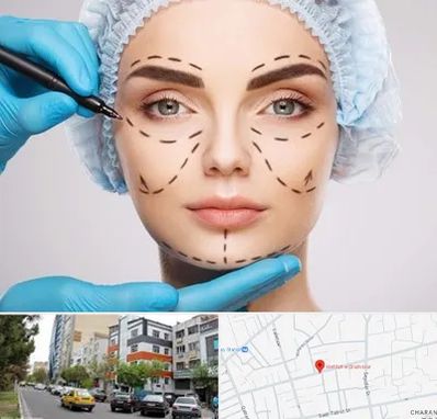 جراح پلاستیک در هفده شهریور تبریز