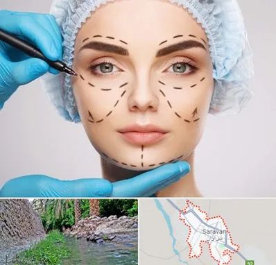 جراح پلاستیک در سراوان