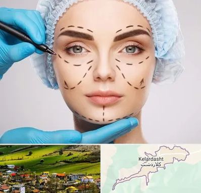 جراح پلاستیک در کلاردشت