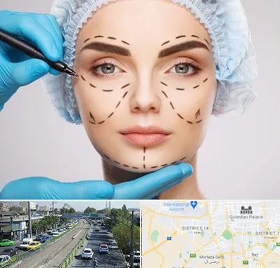 جراح پلاستیک در جنوب تهران