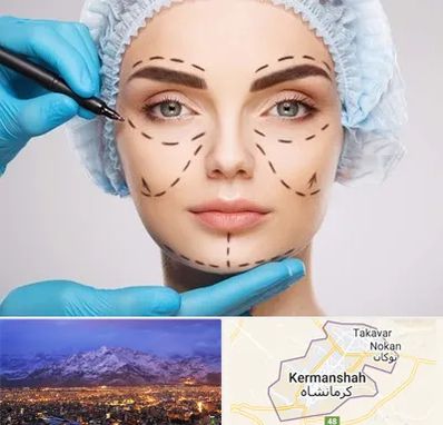 جراح پلاستیک در کرمانشاه