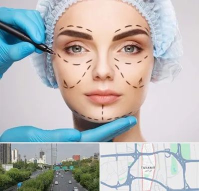 جراح پلاستیک در توانیر