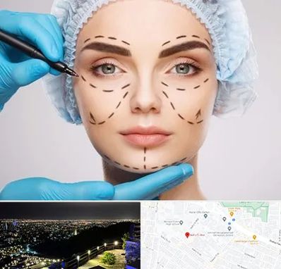 جراح پلاستیک در هفت تیر مشهد