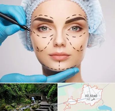 جراح پلاستیک در علی آباد کتول
