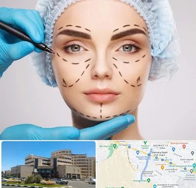 جراح پلاستیک در صیاد شیرازی مشهد