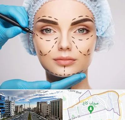 جراح پلاستیک در سعادت آباد تهران