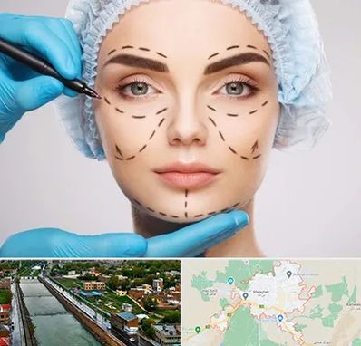 جراح پلاستیک در مراغه