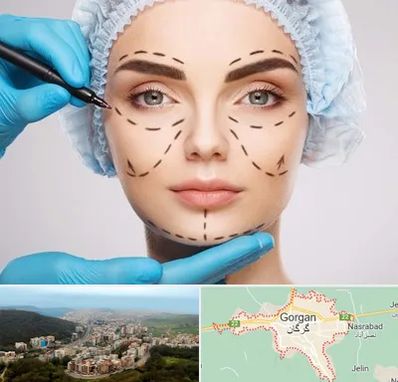 جراح پلاستیک در گرگان