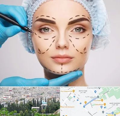 جراح پلاستیک در محلاتی شیراز