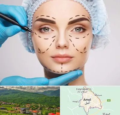 جراح پلاستیک در آمل