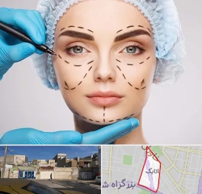 جراح پلاستیک در اتابک