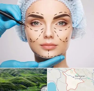 جراح پلاستیک در گچساران
