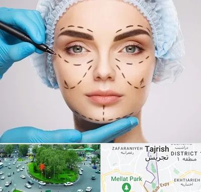 جراح پلاستیک در تجریش