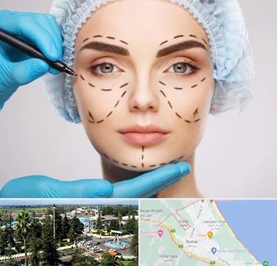 جراح پلاستیک در رودسر