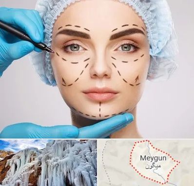 جراح پلاستیک در میگون
