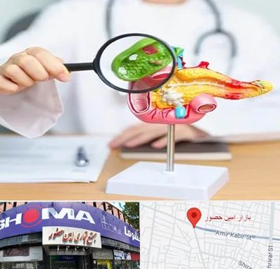 جراح سرطان پانکراس در امین حضور