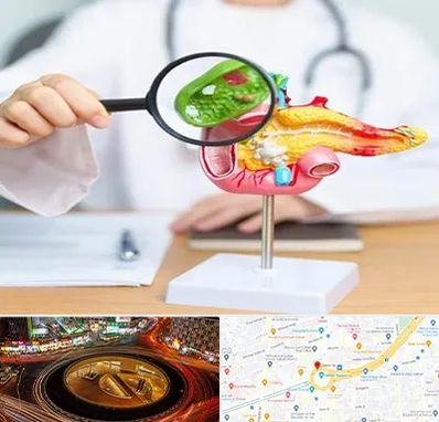جراح سرطان پانکراس در میدان ولیعصر