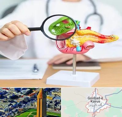 جراح سرطان پانکراس در گنبد کاووس