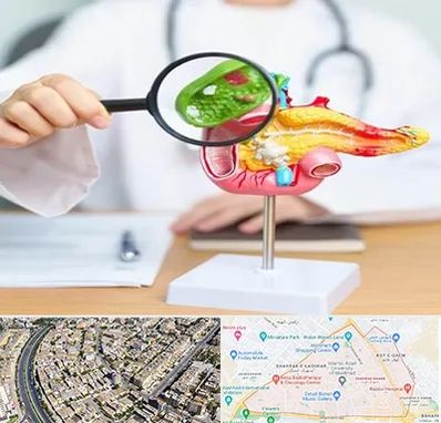 جراح سرطان پانکراس در شهرک غرب مشهد 