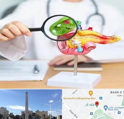 جراح سرطان پانکراس در فلکه گاز شیراز 