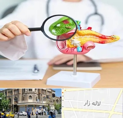 جراح سرطان پانکراس در لاله زار