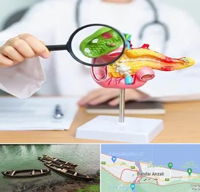 جراح سرطان پانکراس در بندر انزلی