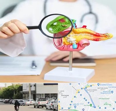 جراح سرطان پانکراس در قدوسی شرقی شیراز 