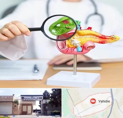 جراح سرطان پانکراس در وحیدیه شهریار